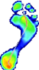 Foot with areas of high pressure shown