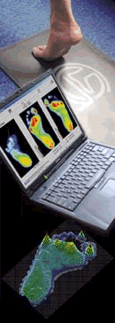 Computerised gait analysis equipment