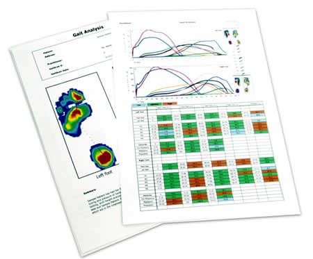 Graph Anlaysis Report