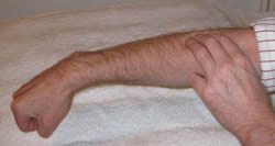 Wrist Flexed Wrist Flexed